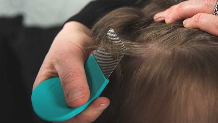 How to get rid of lice?